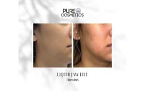 Pure Cosmetics Liquid Jaw Lift before and after
